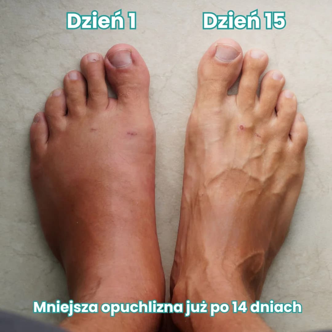 CompressPro - Skarpety uciskowe wspierające krążenie